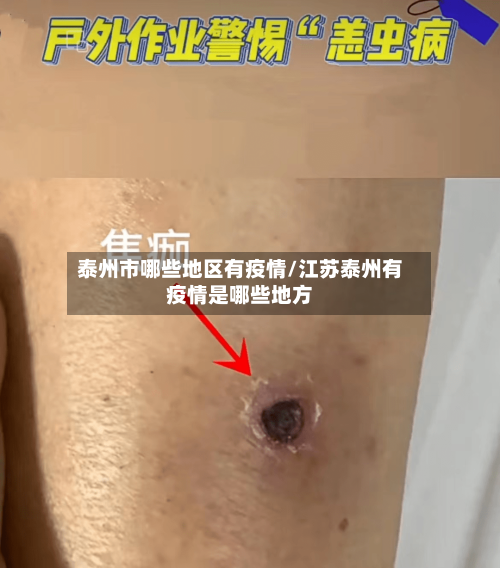 泰州市哪些地区有疫情/江苏泰州有疫情是哪些地方